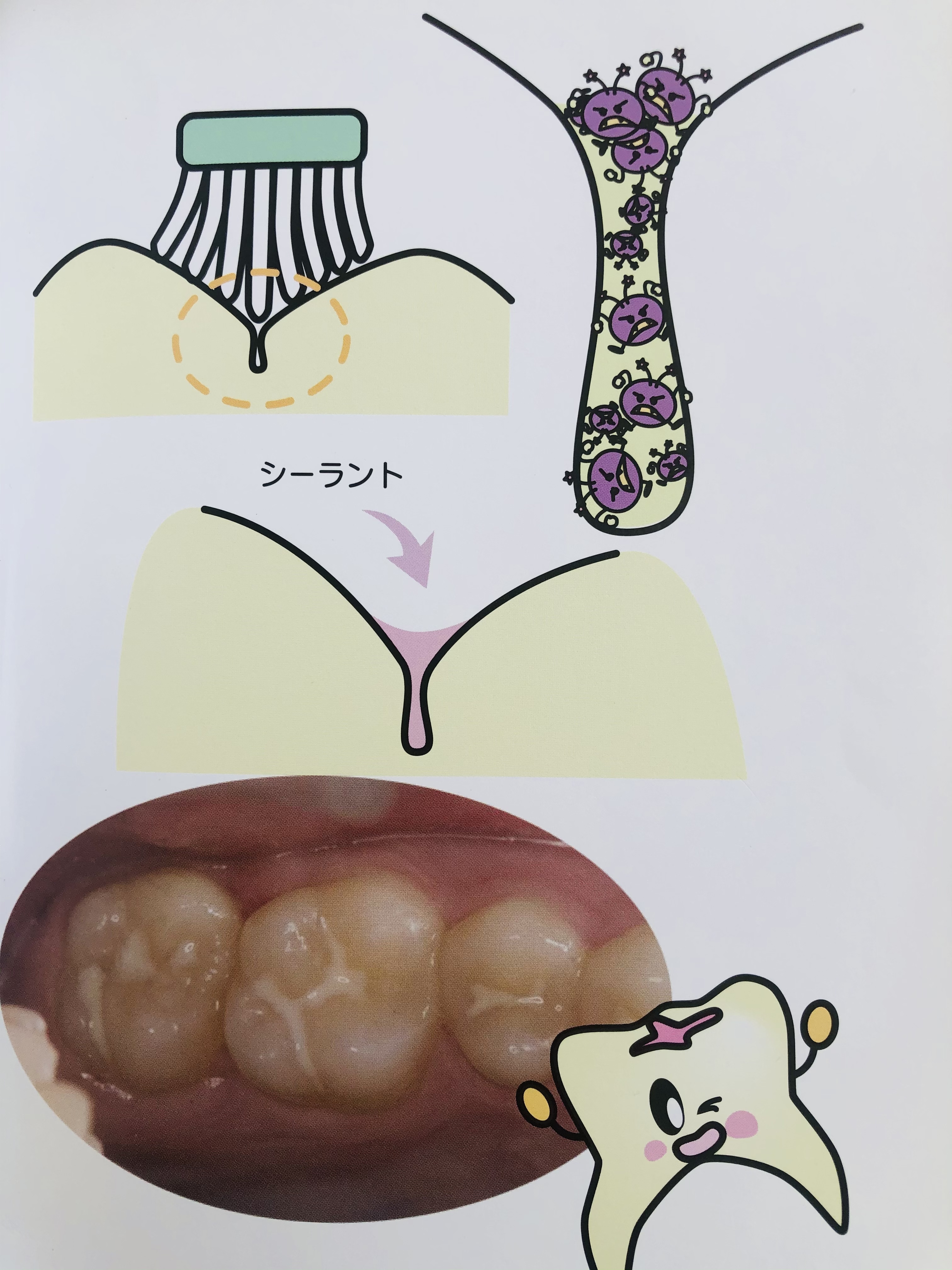 EC87A4BB-4773-4A49-AEAE-70D87E649A9C