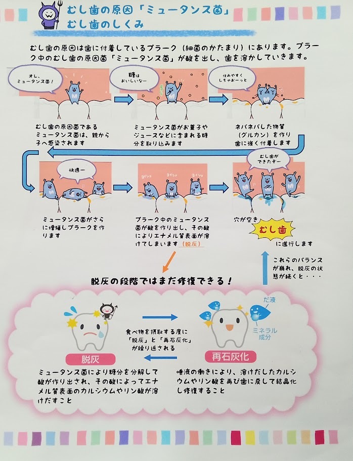 むし歯のしくみ